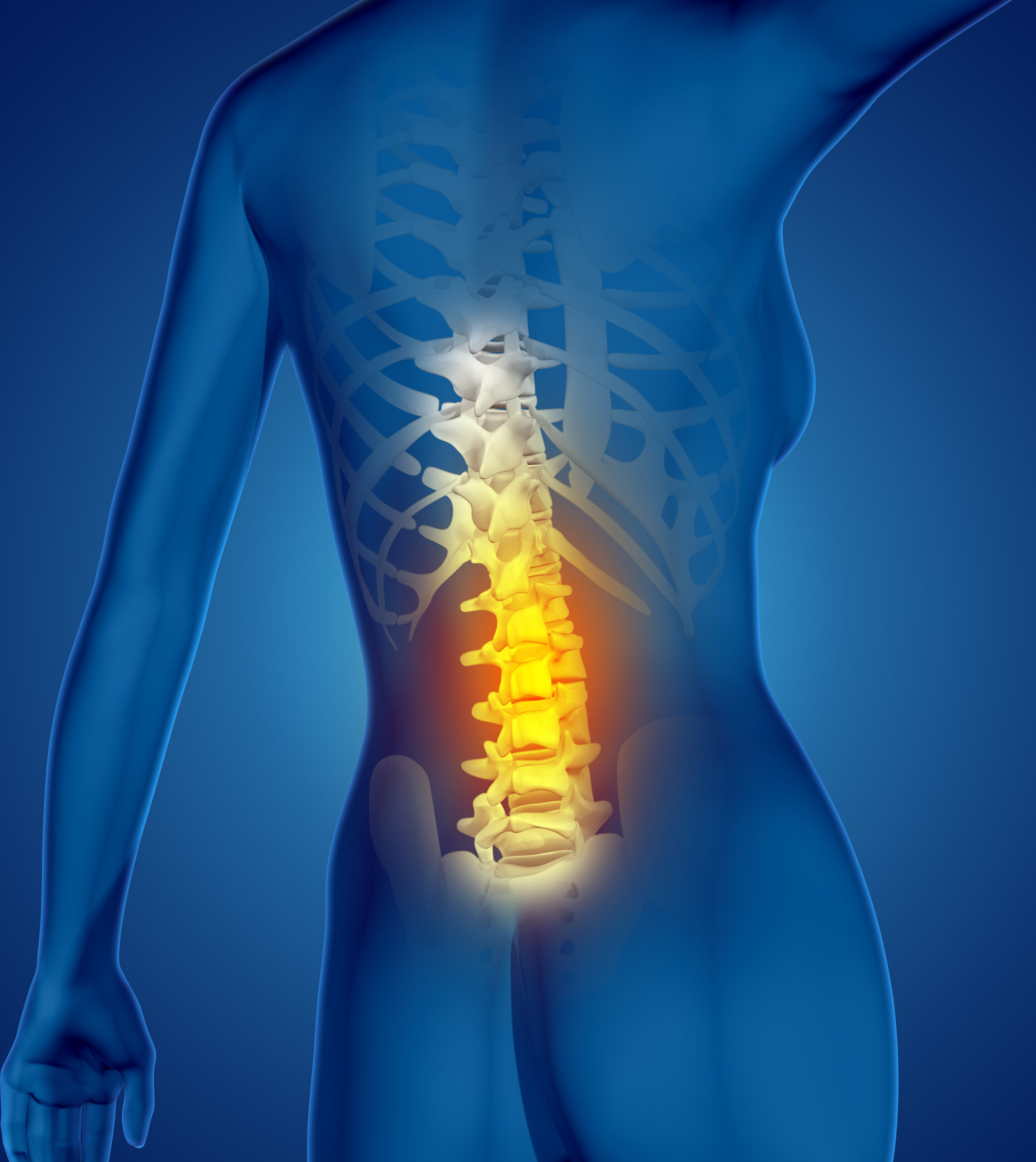 Sciatica/Disc Pain